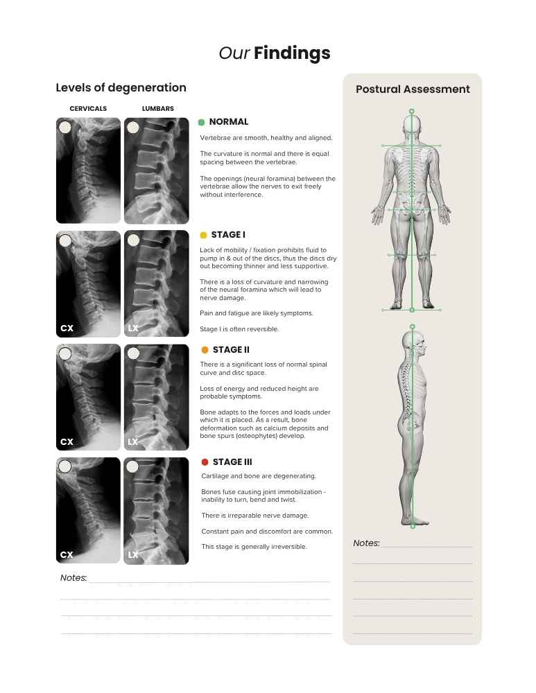 Levels of Degeneration, alternative layout